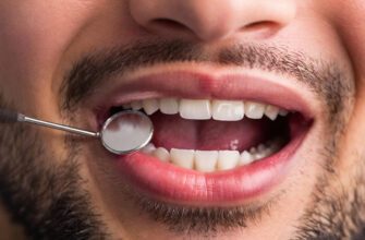 Professional Hollywood Smile dental treatment results in Istanbul Turkey